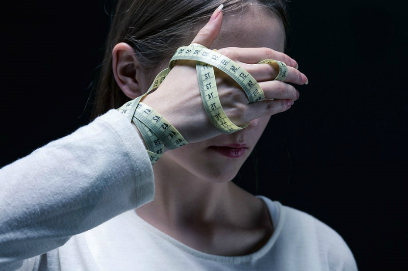 anorexia nerviosa