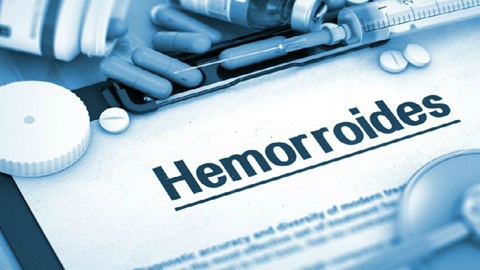 hemorroides