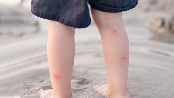 antimosquitos