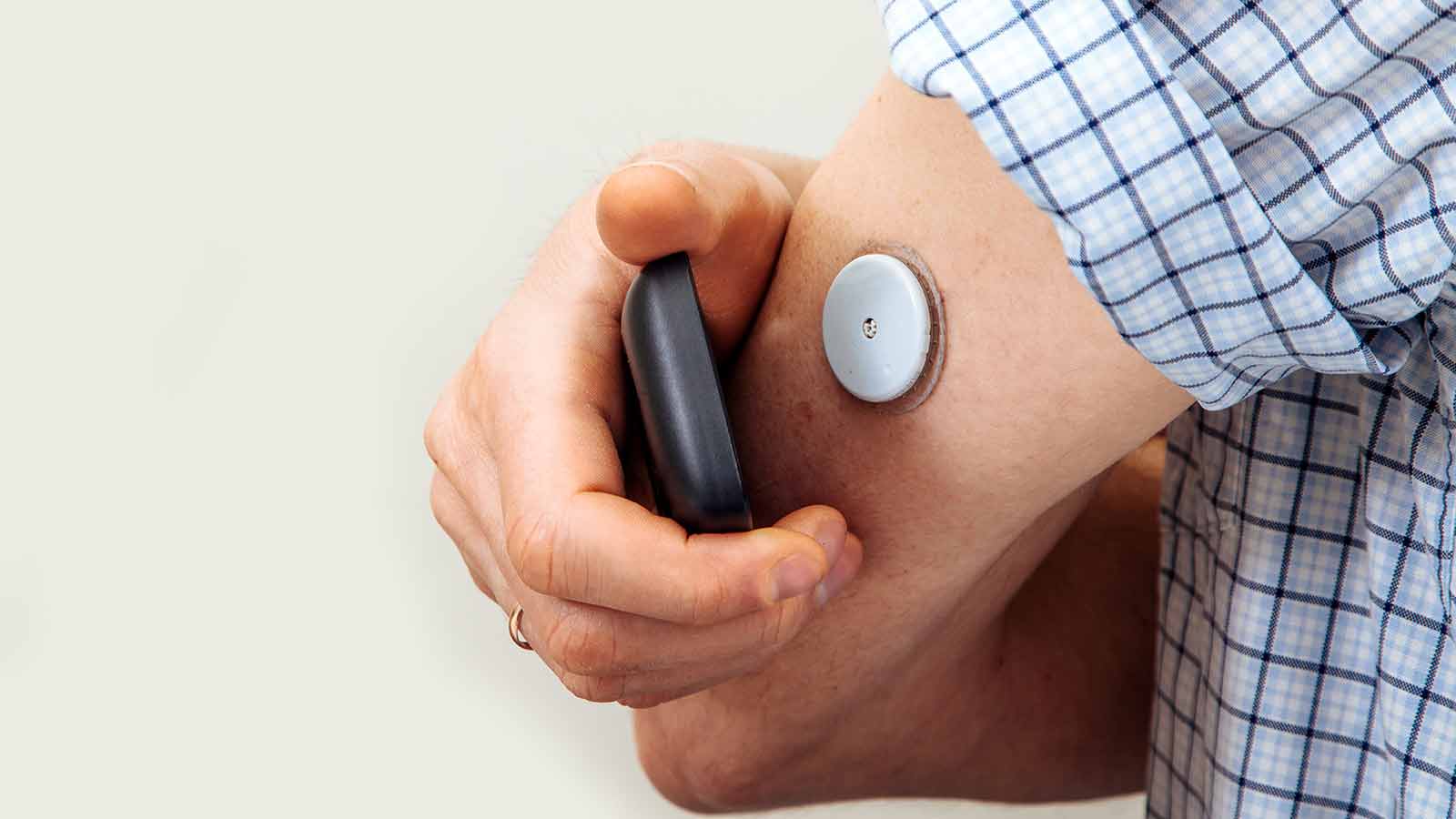 Se amplía la financiación de los sensores flash de glucosa OCU