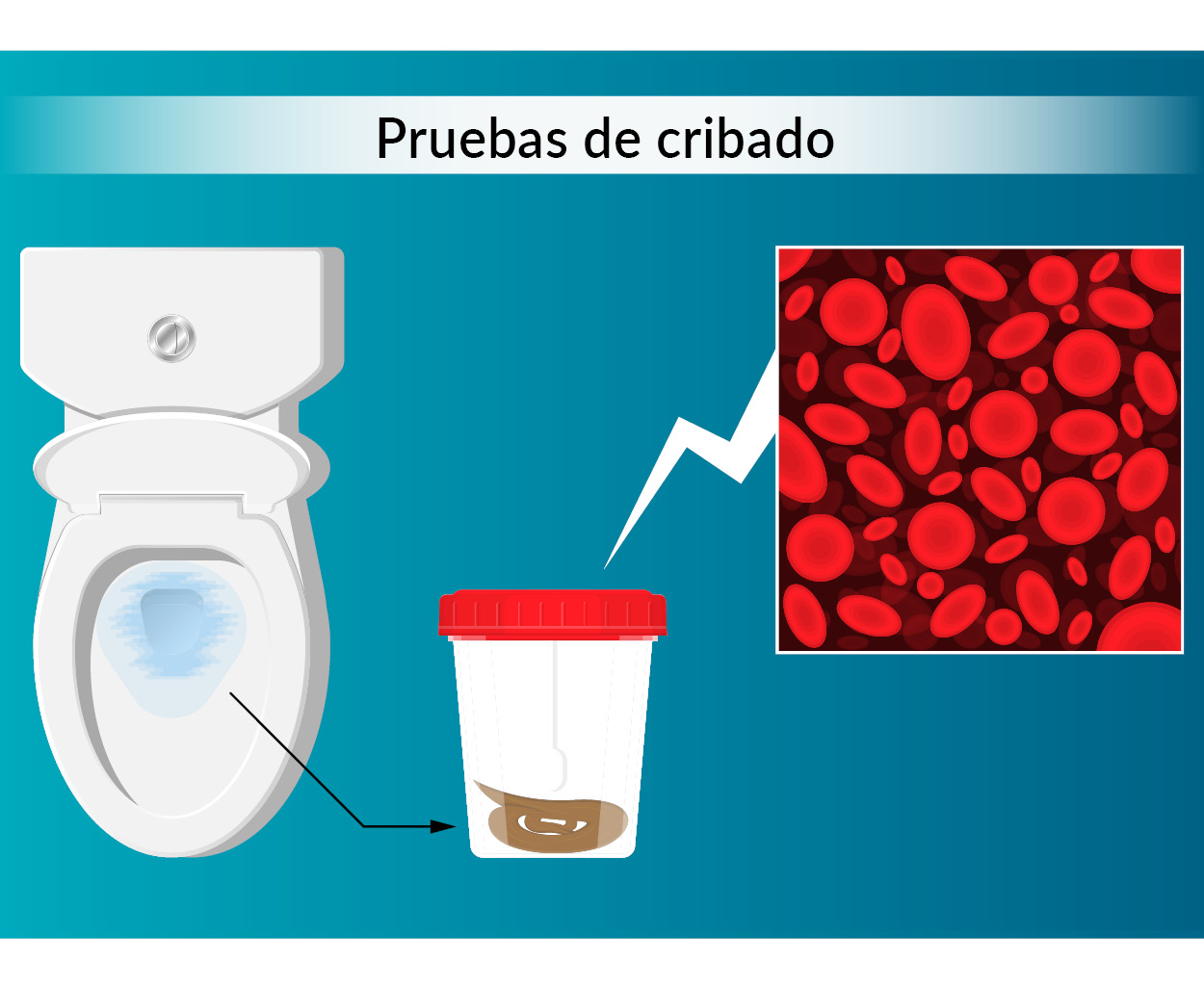 Cáncer de colon: prueba de cribado