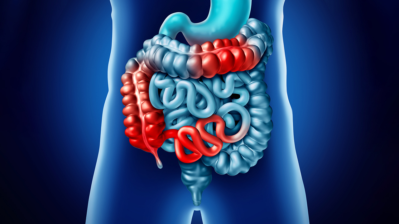 vista del intestino en una imagen tipo rayos X