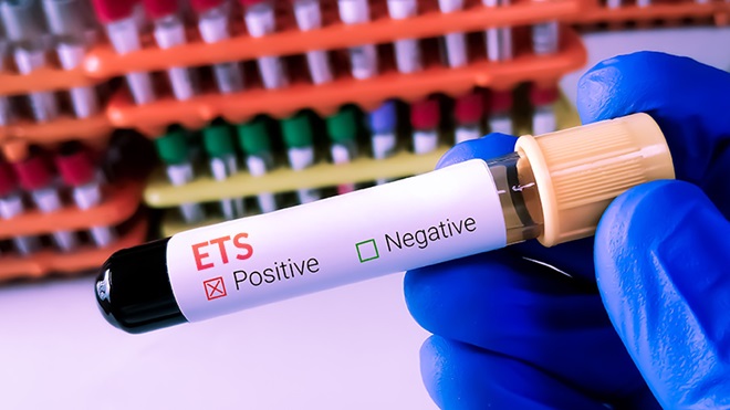 ets