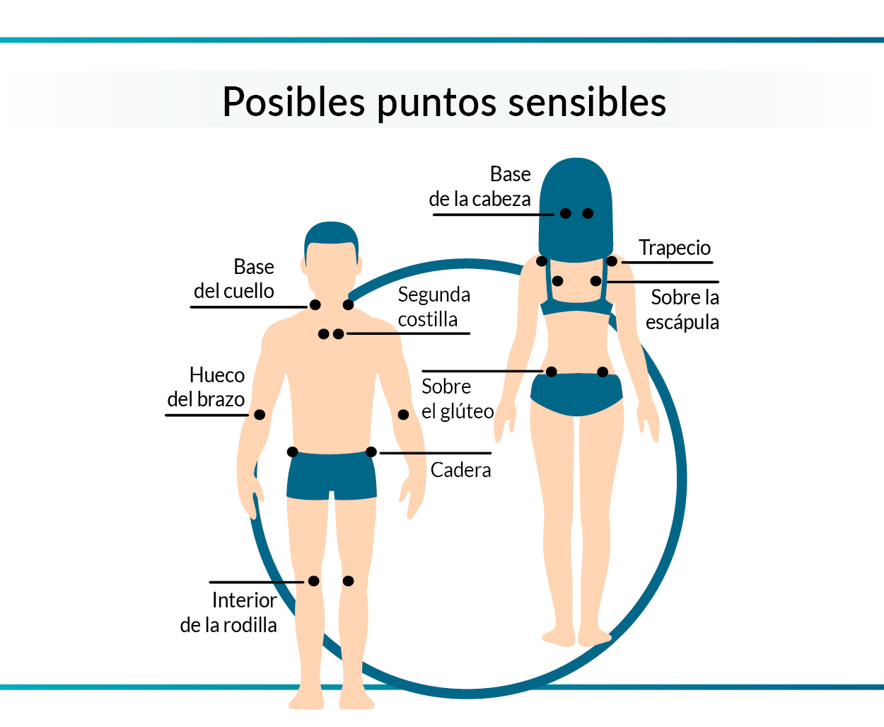 Fibromialgia: localización de 18 posibles puntos de dolor al tacto