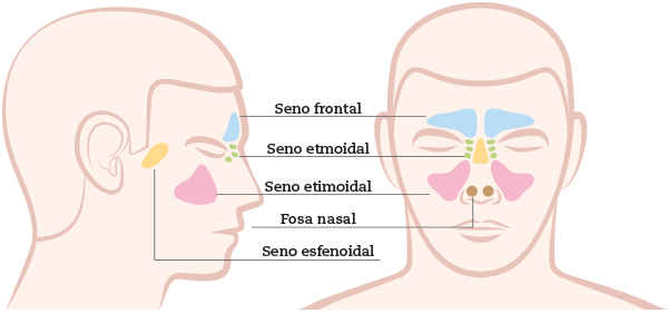 sinusitis-senos-paranasales