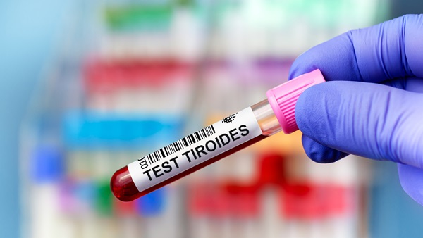Tubo de sangre para analizar hormonas tiroideas