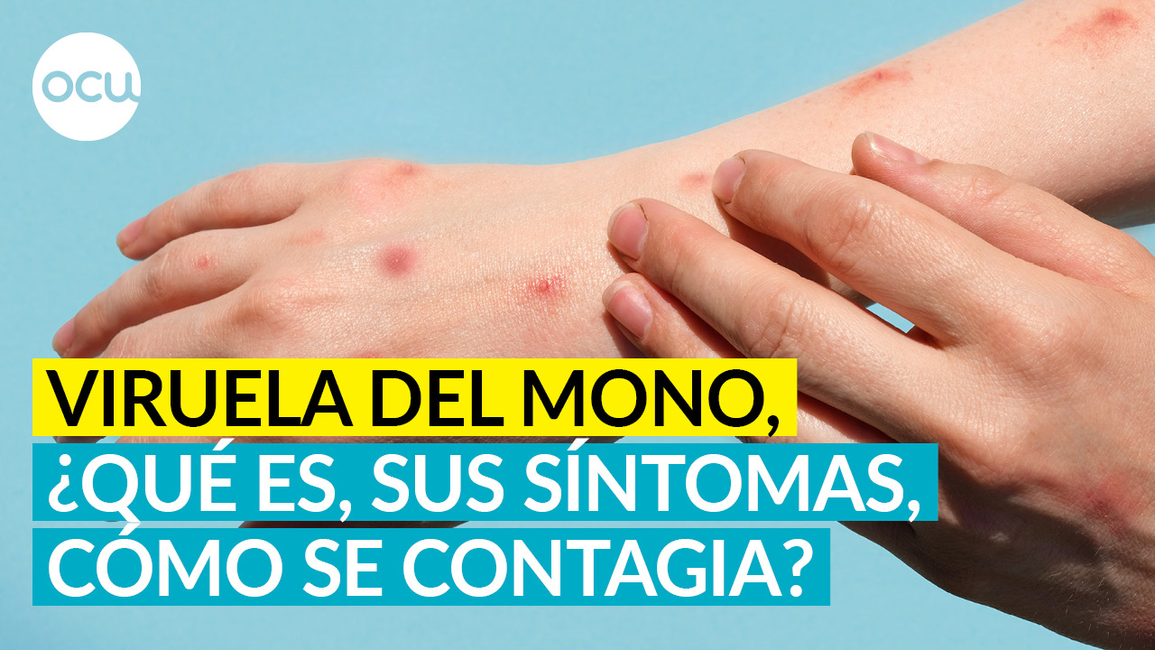 😷VIRUELA DEL MONO, ¿QUÉ ES, CÓMO SE CONTAGIA, ⚡NUEVA EMERGENCIA DE SALUD PÚBLICA INTERNACIONAL?