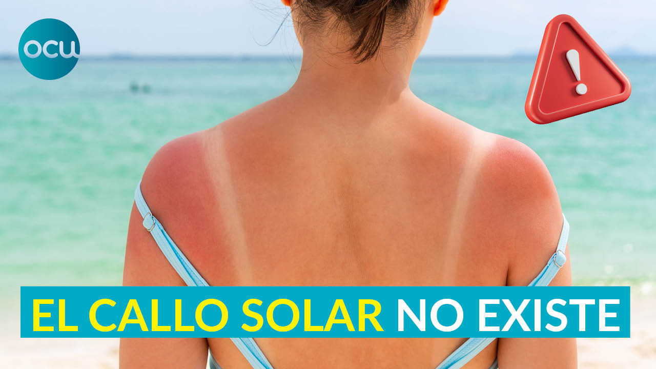 ☀️⚠️Callo solar: el mito que se ha hecho viral